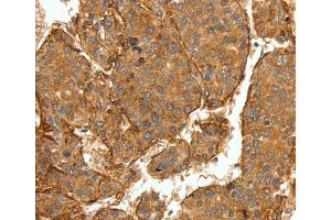 Immunohistochemistry (IHC) image for anti-Collagen, Type IV, alpha 1 (COL4A1) antibody (ABIN2425698) (COL4A1 anticorps)
