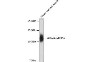 Western blot analysis of extracts of Mouse skeletal muscle, using SERC/ Rabbit mAb (9639) at 1:500 dilution. (ATP2A1/SERCA1 anticorps)