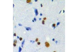 Immunohistochemical analysis of MKI67IP (pT234) staining in human brain formalin fixed paraffin embedded tissue section.