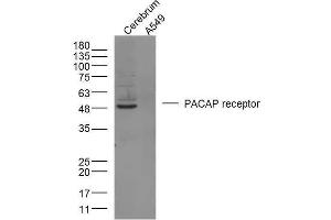 Mouse brain lysates and Human A549 cells probed with PACAP receptor 1 Polyclonal Antibody, unconjugated  at 1:300 overnight at 4°C followed by a conjugated secondary antibody at 1:10000 for 90 minutes at 37°C. (ADCYAP1R1 anticorps  (AA 251-330))