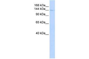 WB Suggested Anti-CIITA Antibody Titration:  0. (CIITA anticorps  (Middle Region))