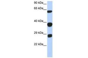 Image no. 1 for anti-Small Nuclear Ribonucleoprotein Polypeptides B and B1 (SNRPB) (AA 72-121) antibody (ABIN6740670) (SNRPB anticorps  (AA 72-121))