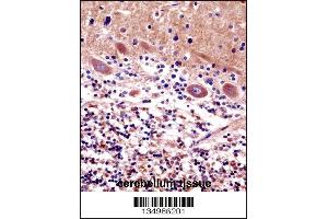 CDR2 Antibody immunohistochemistry analysis in formalin fixed and paraffin embedded human cerebellum tissue followed by peroxidase conjugation of the secondary antibody and DAB staining. (CDR2 anticorps  (C-Term))