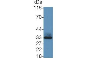 Detection of MDM2 in Mouse Lung lysate using Polyclonal Antibody to Mdm2 p53 Binding Protein Homolog (MDM2)