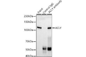 Immunoprecipitation analysis of 300 μg extracts of HepG2 cells using 3 μg ACLY antibody (ABIN1678575, ABIN7101559, ABIN7101560 and ABIN7101561). (ACLY anticorps)