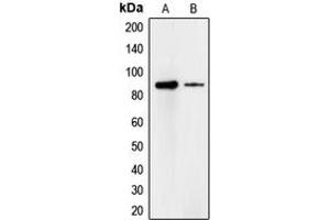 Western blot analysis of Cadherin 18 expression in A549 (A), HeLa (B) whole cell lysates. (CDH18 anticorps  (Center))