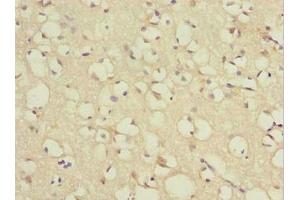 Immunohistochemistry of paraffin-embedded human brain tissue using ABIN7172431 at dilution of 1:100