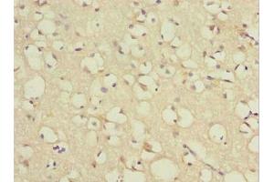 Immunohistochemistry of paraffin-embedded human brain tissue using ABIN7172431 at dilution of 1:100 (TCEAL7 anticorps  (AA 1-100))