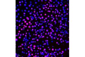 Immunofluorescence of paraffin embedded mouse pancreas using ZNF106 (ABIN7076260) at dilution of 1:500 (400x lens)