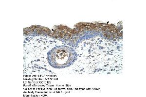 Rabbit Anti-EIF2A Antibody  Paraffin Embedded Tissue: Human Skin Cellular Data: Epidermal cells Antibody Concentration: 4.