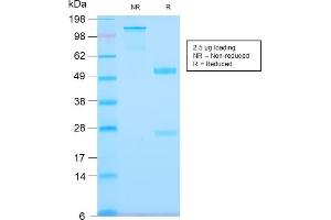 SDS-PAGE Analysis Purified Tenascin C Rabbit Recombinant Monoclonal Antibody (TNC/2981R). (Recombinant TNC anticorps)