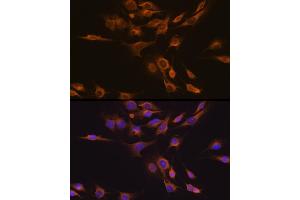 Immunofluorescence analysis of C6 cells using CNTF Rabbit pAb (ABIN3015704, ABIN3015705, ABIN3015706 and ABIN6219054) at dilution of 1:100 (40x lens). (CNTF anticorps  (AA 1-200))
