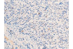ABIN6267284 at 1/100 staining mouse gastric tissue sections by IHC-P.