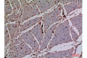 Immunohistochemical analysis of paraffin-embedded rat muscle, antibody was diluted at 1:100. (CDK4 anticorps  (N-Term))