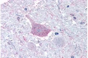 Anti-MRGPRD antibody  ABIN1049069 IHC staining of human brain, medulla. (MRGPRD anticorps  (Cytoplasmic Domain))