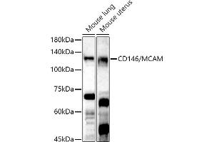 Western blot analysis of extracts of various cell lines, using CD146/MCAM antibody (ABIN6127568, ABIN6143621, ABIN6143622 and ABIN6218100) at 1:500 dilution. (MCAM anticorps  (AA 447-646))