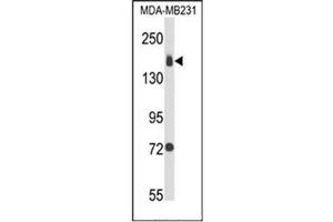 Western blot analysis of CD49b / ITGA2 Antibody (C-term) in MDA-MB231 cell line lysates (35ug/lane). (ITGA2 anticorps  (C-Term))
