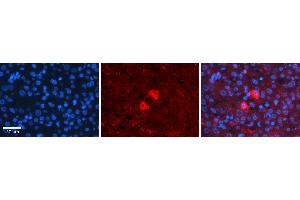 Rabbit Anti-RELA Antibody   Formalin Fixed Paraffin Embedded Tissue: Human Liver Tissue Observed Staining: Cytoplasm in hepatocytes Primary Antibody Concentration: 1:100 Other Working Concentrations: N/A Secondary Antibody: Donkey anti-Rabbit-Cy3 Secondary Antibody Concentration: 1:200 Magnification: 20X Exposure Time: 0.