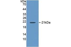 Detection of Recombinant RSPO1, Rat using Polyclonal Antibody to R-Spondin 1 (RSPO1)