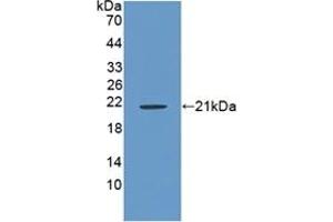 Detection of Recombinant RSPO1, Rat using Polyclonal Antibody to R-Spondin 1 (RSPO1) (RSPO1 anticorps  (AA 136-262))