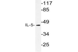 Western blot (WB) analysis of IL-5 antibody in extracts from HT-29 cells. (IL-5 anticorps)