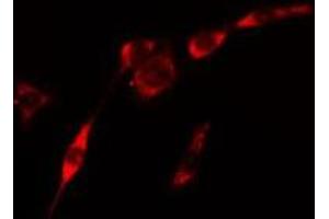 ABIN6275436 staining Hela cells by IF/ICC.