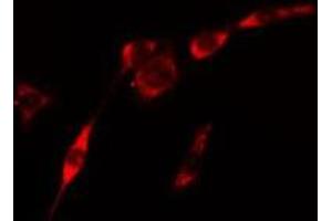 ABIN6275436 staining Hela cells by IF/ICC. (RAB3GAP2 anticorps  (Internal Region))