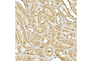 Immunohistochemistry of paraffin-embedded rat ovary using DNA Ligase III/LIG3 Rabbit pAb (ABIN6130288, ABIN6143207, ABIN6143208 and ABIN6217532) at dilution of 1:50 (40x lens).