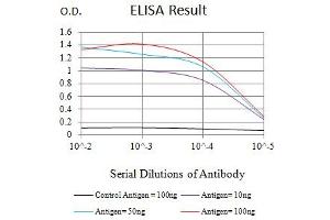 Black line: Control Antigen (100 ng),Purple line: Antigen (10 ng), Blue line: Antigen (50 ng), Red line:Antigen (100 ng) (KRT20 anticorps  (AA 1-150))