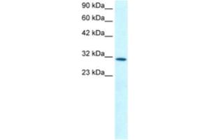 Western Blotting (WB) image for anti-Kruppel-Like Factor 8 (KLF8) antibody (ABIN2460245) (KLF8 anticorps)
