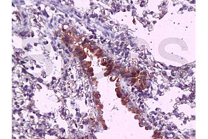 Formalin-fixed and paraffin embedded mouse lung tissue labeled with Anti-MyD88 Polyclonal Antibody, Unconjugated (ABIN736881) at 1:200, followed by conjugation to the secondary antibody and DAB staining