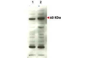Western blot using SMAD4 polyclonal antibody  to detect over-expressed SMAD4 in transfected COS cells (lane 2). (SMAD4 anticorps  (C-Term))