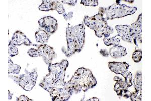 IHC analysis of DBI using anti-DBI antibody .