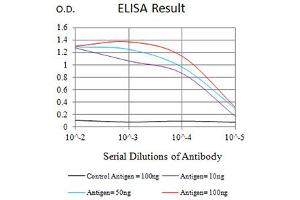 Black line: Control Antigen (100 ng),Purple line: Antigen (10 ng), Blue line: Antigen (50 ng), Red line:Antigen (100 ng)