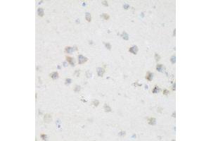 Immunohistochemistry of paraffin-embedded mouse brain using NFU1 antibody at dilution of 1:200 (40x lens). (NFU1 anticorps)