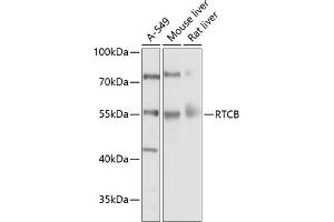 Western blot analysis of extracts of various cell lines, using RTCB Antibody (ABIN6127939, ABIN6147287, ABIN6147288 and ABIN6214508) at 1:1000 dilution. (C22orf28 anticorps  (AA 236-505))