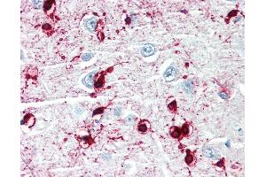 anti-Crystallin, alpha B (CRYAB) antibody