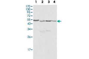 Western blot analysis of CALR monoclonal antibody, clone 1G6A7  against HeLa (1), A-549 (2), NTERA2 (3) and MCF-7 (4) cell lysate. (Calreticulin anticorps)