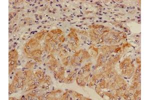 Immunohistochemistry of paraffin-embedded human adrenal gland tissue using ABIN7143672 at dilution of 1:100