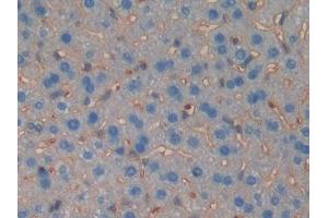 Detection of MUSK in Mouse Liver Tissue using Polyclonal Antibody to Muscle, Skeletal, Receptor Tyrosine Kinase (MUSK)