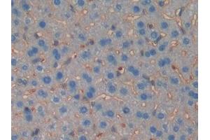 Detection of MUSK in Mouse Liver Tissue using Polyclonal Antibody to Muscle, Skeletal, Receptor Tyrosine Kinase (MUSK) (MUSK anticorps  (AA 517-777))