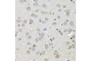 Immunohistochemistry of paraffin-embedded rat brain using SPR antibody.