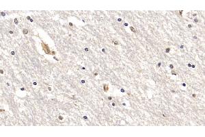 Detection of IL18R1 in Human Cerebrum Tissue using Monoclonal Antibody to Interleukin 18 Receptor 1 (IL18R1)
