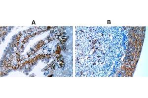 Immunohistochemistry (IHC) image for anti-Syndecan 1 (SDC1) antibody (ABIN487501) (Syndecan 1 anticorps)