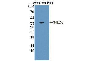 Western blot analysis of the recombinant protein. (Phospholipase C delta 3 anticorps  (AA 528-789))