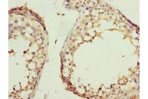 Immunohistochemistry of paraffin-embedded human testis tissue using ABIN7157234 at dilution of 1:100 (KANSL3 anticorps  (AA 1-200))