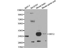 Western blot analysis of extracts of various cell lines, using SIRT2 antibody. (SIRT2 anticorps  (AA 288-389))