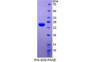 SDS-PAGE (SDS) image for Ferritin, Light Polypeptide (FTL) (AA 2-175) protein (His tag) (ABIN1878637)