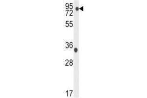 Western blot analysis of TBK1 antibody and K562 lysate. (TBK1 anticorps  (AA 150-181))