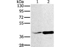 Western blot analysis of Hela and A549 cell, using NDUFA10 Polyclonal Antibody at dilution of 1:500 (NDUFA10 anticorps)